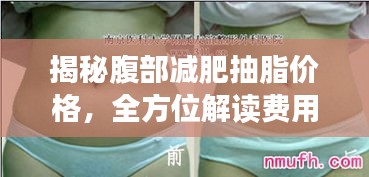 揭秘腹部减肥抽脂价格，全方位解读费用因素！